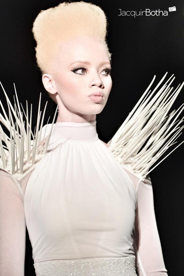 TOP 5 A-LISTED ALBINO SUPERMODELS. – The A-List by Marcel Temba